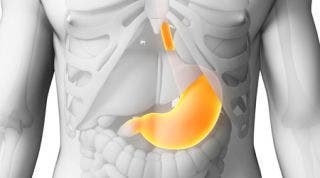 ¿Cómo repercute la disfunción de estómago sobre el sistema Músculo-esquelético?