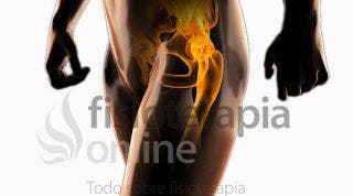 Fracturas de pelvis y cadera