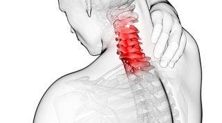 Artrosis cervical o Cervicoartrosis. Causas, síntomas y tratamiento