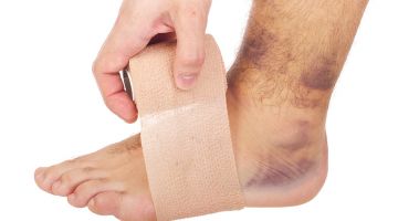 Resultado de imagen para esguince cronico de tobillo