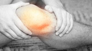 Todo lo que debes saber sobre la Tendinitis