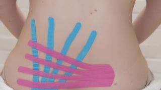 ¿Esparadrapo de colores? No, Kinesio-Taping ¿Esparadrapo de colores? No, Kinesio-Taping