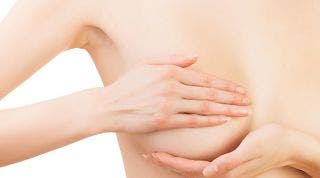 Mastectomía. Consejos de un fisioterapeuta en el post operatorio Mastectomía. Consejos de un fisioterapeuta en el post operatorio