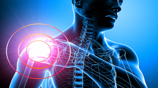 ¿Cómo ayuda la fisioterapia a aliviar el dolor de hombro ocasionado por tendinitis y bursitis?