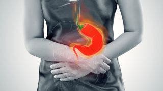 Hernia de hiato: qué es, síntomas, causas y tratamiento Hernia de hiato: qué es, síntomas, causas y tratamiento