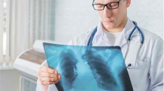 Lo que necesitas saber sobre la fibrosis quística. Lo que necesitas saber sobre la fibrosis quística.