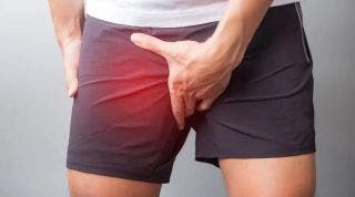 Diagnóstico de la pubalgia u osteopatía de pubis. Cómo saber si la padeces.