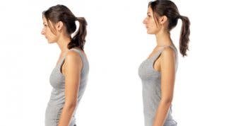 Hipercifosis Dorsal. Qué es, tipos y ejercicio recomendado Hipercifosis Dorsal. Qué es, tipos y ejercicio recomendado