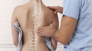 ¿Tienes una escoliosis funcional? Cómo la disfunción visceral puede modificar tu postura