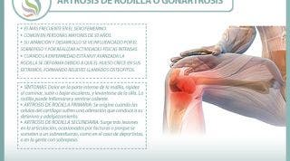 Todo lo que necesitas saber de la artrosis de rodilla o gonartrosis