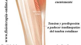 Fascitis plantar, juanetes, neuroma de Morton, conoce las consecuencias para tu salud, del uso continuado de los zapatos de tacón