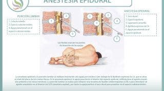 Anestesia epidural, descubre sus indicaciones y sus peligros