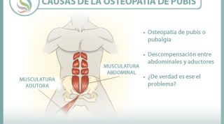 Causas de la osteopatía de pubis o pubalgia, una nueva visión
