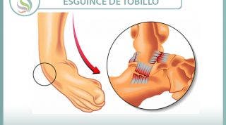 Esguince o torcedura de tobillo - 29 vídeos sobre esta lesión