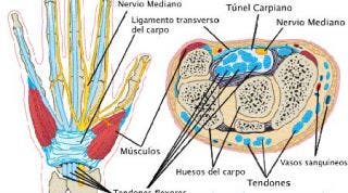 Síndrome del túnel carpiano. Causas y tratamiento