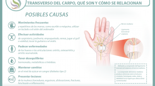 El síndrome del túnel carpiano y el ligamento transverso del carpo, aprende qué son y cómo se relacionan