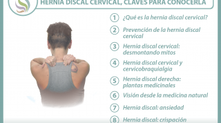 Hernia discal cervical, 23 interesantes vídeos sobre el tema Hernia discal cervical, 23 interesantes vídeos sobre el tema