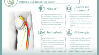 Síndrome del músculo piramidal. Qué es, causas, síntomas y tratamiento Síndrome del músculo piramidal. Qué es, causas, síntomas y tratamiento