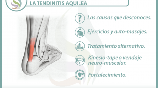 5 claves para entender y tratar la tendinitis aquilea