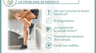  5 claves para entender y tratar un problema de menisco