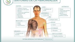 Fibromialgia. Causas, sintomas, diagnóstico y tratamiento