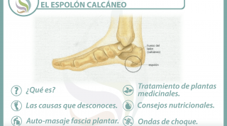 6 claves para entender y tratar el espolón calcáneo 6 claves para entender y tratar el espolón calcáneo