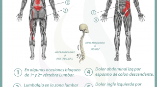 Relación entre el colon irritable y el dolor de espalda