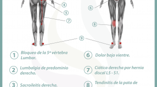 Relación entre el útero y el dolor de espalda