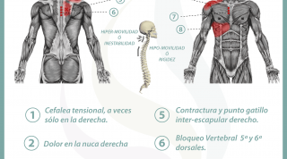 Relación entre el hígado y el dolor de espalda