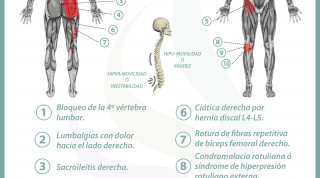 Relación del intestino delgado con el dolor de espalda