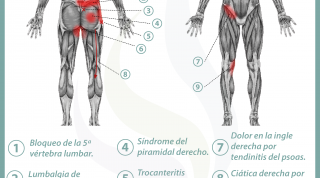 Relación entre próstata y dolor de espalda