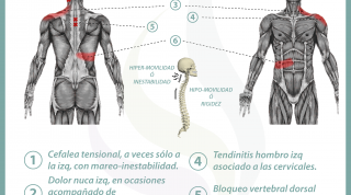 Relación entre vesícula y dolor de espalda
