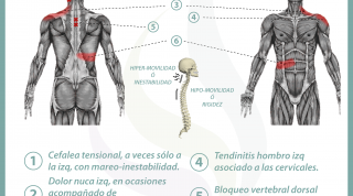 Relación entre vesícula y dolor de espalda Relación entre vesícula y dolor de espalda