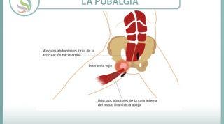 La pubalgia el castigo del futbolista