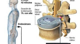 El avance de la videoendoscopia 