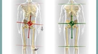 Equilibrio postural y disfunciones articulares o como las postura afecta a nuestro organismo