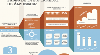 El camino de la enfermedad de Alzheimer, un enfoque desde la fisioterapia