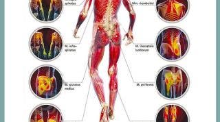 Puntos gatillo de la zona dorsal, los causantes musculares de la dorsalgia