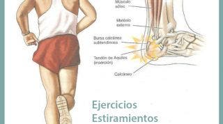 La tendinitis o tendinosis de Aquiles, qué es, cómo se produce y unas útiles herramientas para tratarla