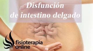 Disfunción de intestino delgado, o como el intestino puede influir en tu dolor de espalda