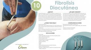 Fibrolisis Diacutanea o Técnica de ganchos. Te ayuda más de lo que te asusta