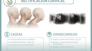 La rectificación cervical, una disfunción en auge, descubre qué es y a que se debe