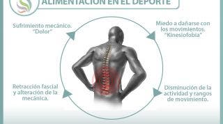 El circulo vicioso de la lumbalgia o dolor lumbar