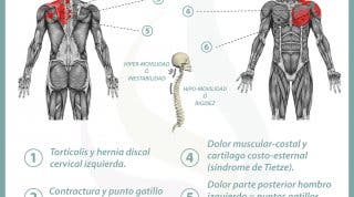 Relación entre el estómago y el dolor de espalda