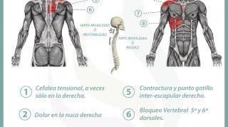 Relación entre el hígado y el dolor de espalda