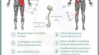 Relación del intestino delgado con el dolor de espalda