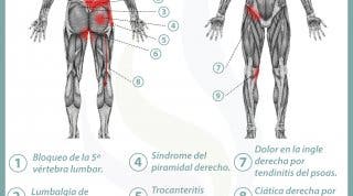 Relación entre próstata y dolor de espalda