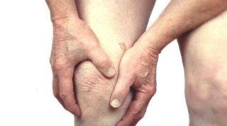 Rodilla artrítica: qué es, factores de riesgo, diagnóstico y opciones de tratamiento