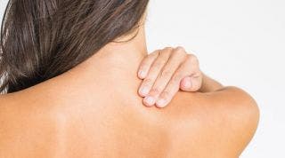 Espondilosis cervical: qué es, síntomas, causas y tratamiento