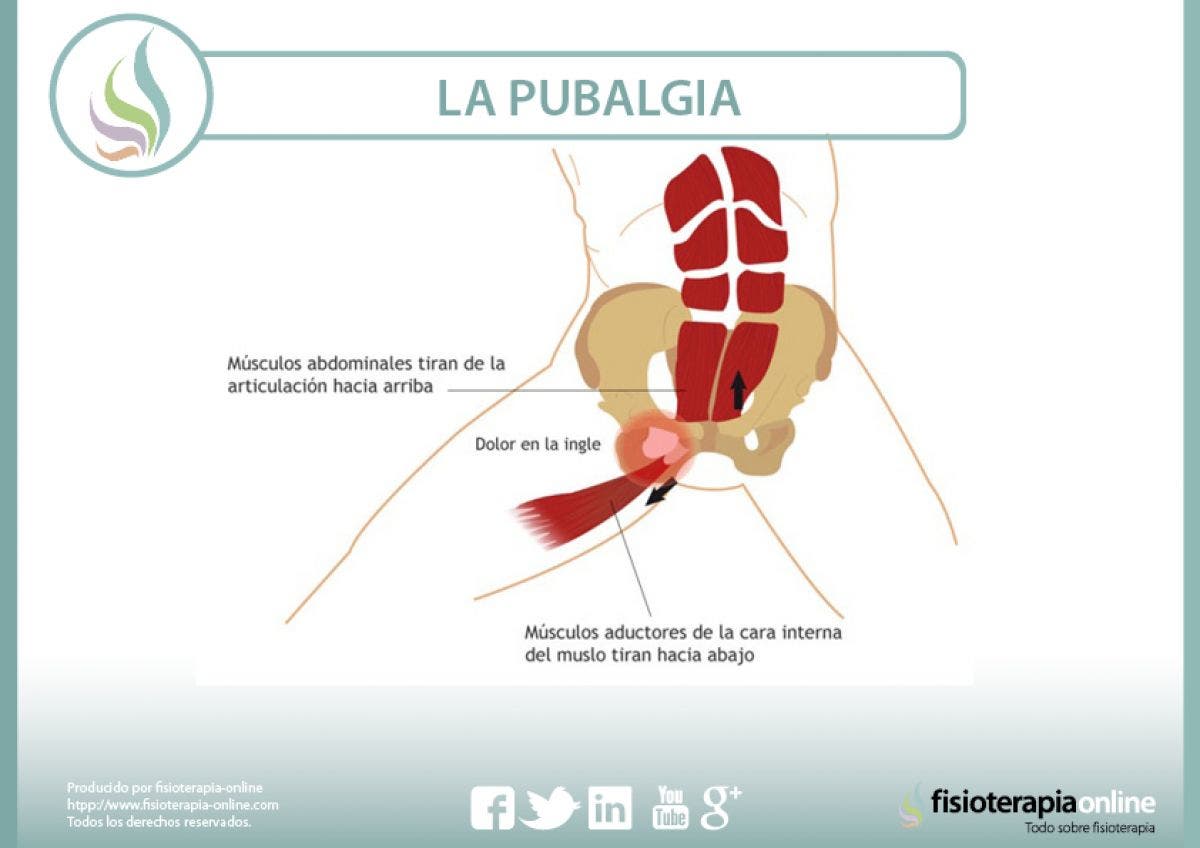 La pubalgia el castigo del futbolista